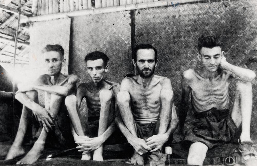 Australian and Dutch prisoners of war with beri beri at Tarsau in Thailand, 1943 (Australian War Memorial P00761.011)
